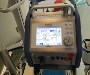 W Białymstoku powstało centrum leczenia pacjentów z ciężką niewydolnością oddechową [ZDJĘCIA, AUDIO]