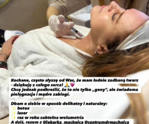 Agnieszka Kotońska pokazała stare zdjęcie i zdradziła, ile najwięcej ważyła. Nie do wiary, jak bardzo się zmieniła