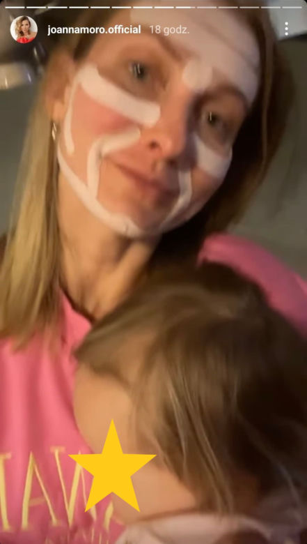 Co Joanna Moro zrobiła z twarzą?