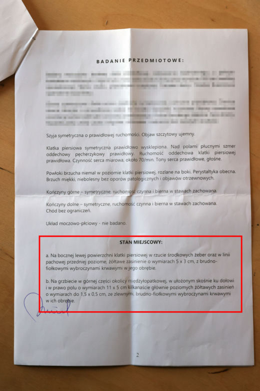 Franek Broda obdukcja