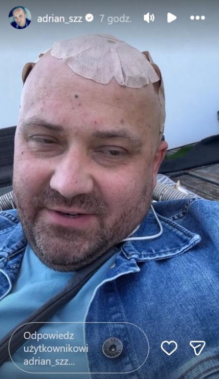 Adrian ze "Ślubu od Pierwszego Wejrzenia" ma obrzęk mózgu. Walczy też z podwójnym widzeniem
