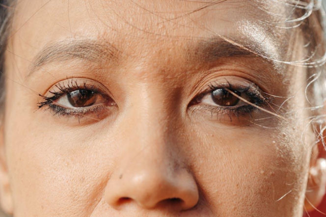 Zbliżenie na oczy kobiety z widocznymi podkrążonymi powiekami i cieniami pod oczami, symbolizujące zmęczenie i problemy z wyglądem, o których możesz przeczytać na portalu Poradnik Zdrowie. W tle rozmyte jasne tło.