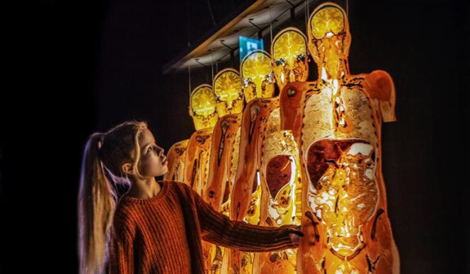 Body Worlds