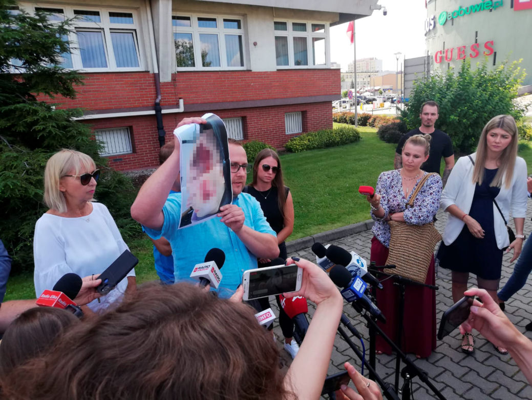 Lubin. Konferencja prasowa rodziny zmarłego Bartosza S.