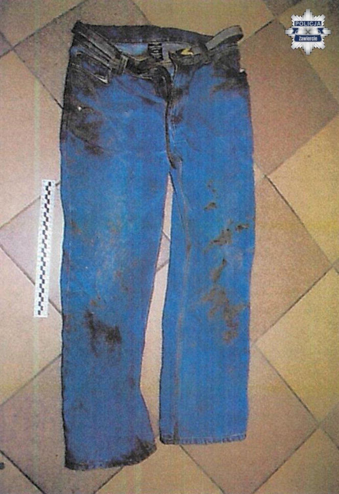 Policja z Zawiercia chce zidentyfikować ciało mężczyzny o srebrnych zębach. Znaleźli je 11 lat temu