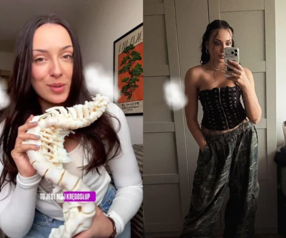 Niesamowita metamorfoza Mai Kapłon. Uczestniczka The Voice of Poland przeszła wiele operacji kręgosłupa. Teraz promienieje!