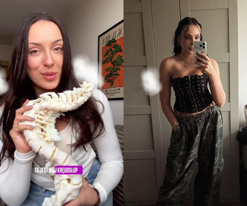 Maja Kapłon trzyma model skrzywionego kręgosłupa. Obok zdjęcie wokalistki w gorsecie. O jej zdrowiu przeczytasz na Eska.