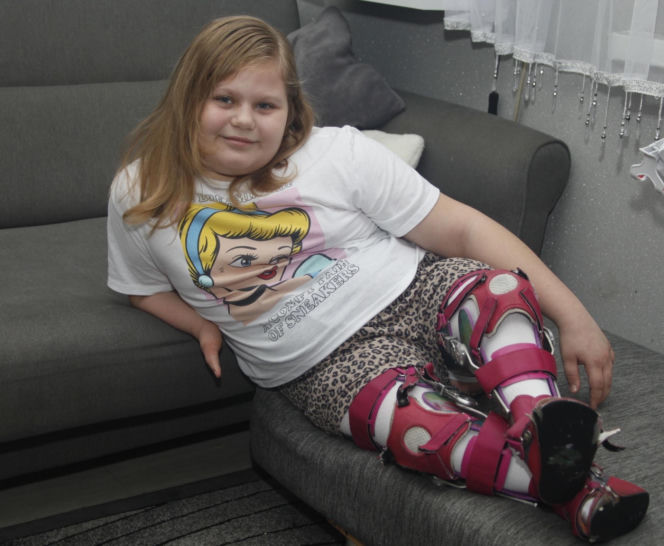 Podarujmy Amelce protezy pod choinkę