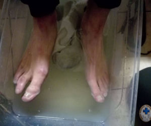Poszedł w Bieszczady w dresie i butach na budowę. Wrócił z odmrożeniami [ZDJĘCIA]
