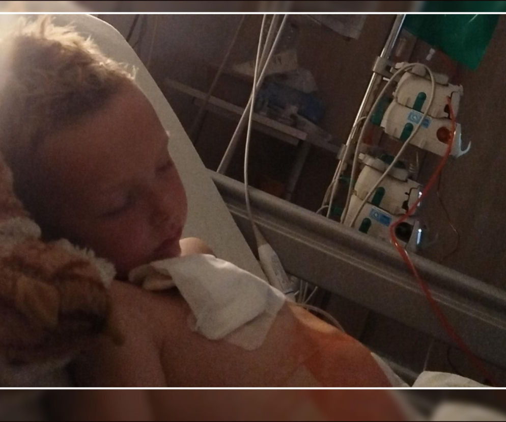 Chory chłopiec leży w łóżku podłączony do aparatury medycznej. O walce 5-letniego Franka przeczytasz na Eska Poznań.