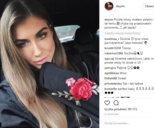 Deynn - przed operacją worków pod oczami