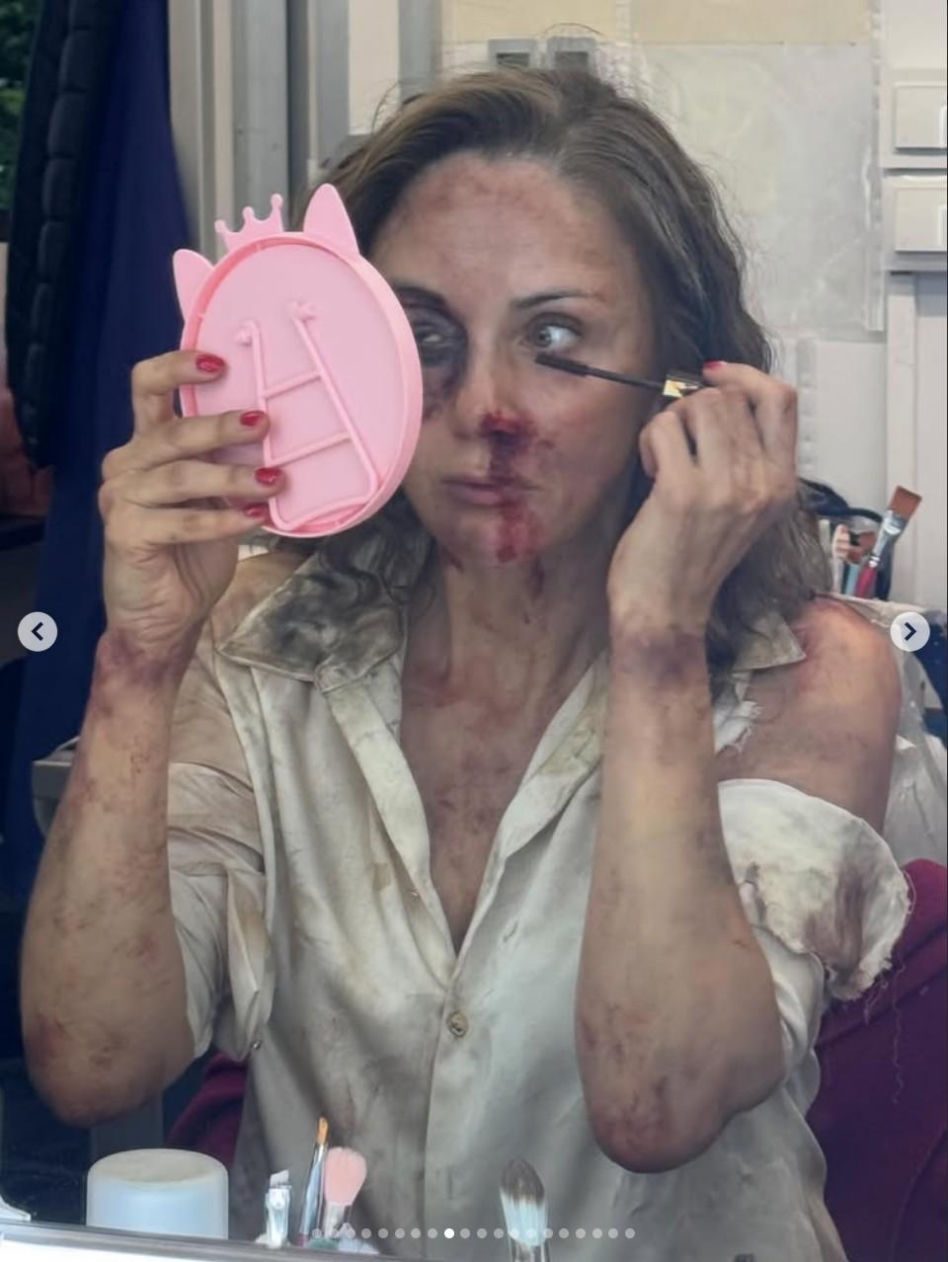 Ranczo. Lucy (Ilona Ostrowska) zginie w nowym sezonie?! Obrażenia aktorki wyglądają przerażająco