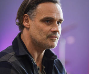 Jan Wieczorkowski przed przeszczepem włosów