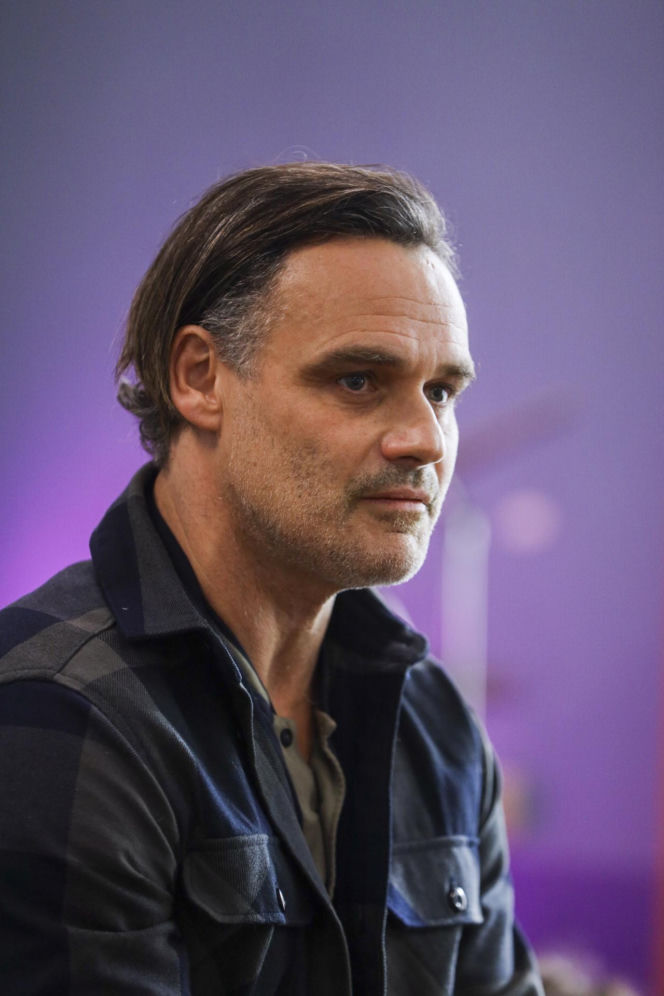 Jan Wieczorkowski przed przeszczepem włosów