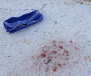 12-letni Dawid zjeżdżał z górki, nie żyje. Uderzył głową o ławkę