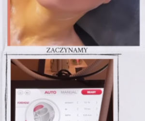 Rozenek razi twarz prądem
