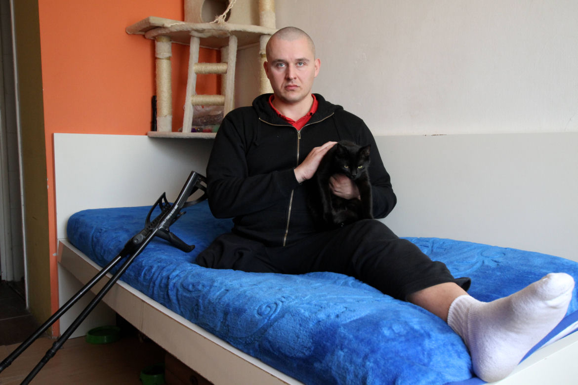 Przez urzędników stracę nogę