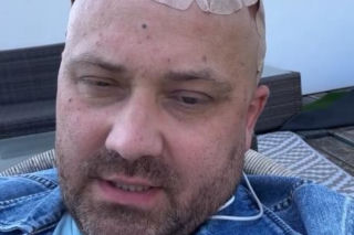 Adrian ze Ślubu od Pierwszego Wejrzenia ma obrzęk mózgu. Walczy też z podwójnym widzeniem