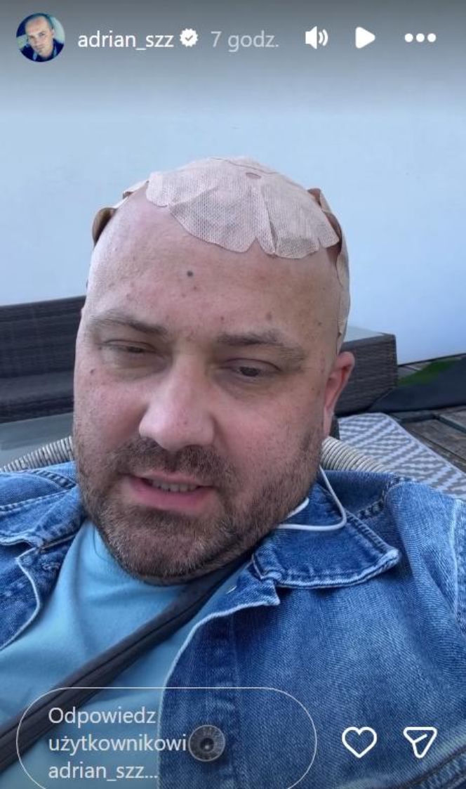 Adrian ze "Ślubu od Pierwszego Wejrzenia" ma obrzęk mózgu. Walczy też z podwójnym widzeniem