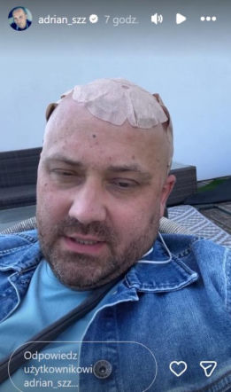 Adrian ze "Ślubu od Pierwszego Wejrzenia" ma obrzęk mózgu. Walczy też z podwójnym widzeniem