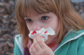 Krew z nosa u dziecka? Ten popularny błąd przy tamowaniu może być groźny