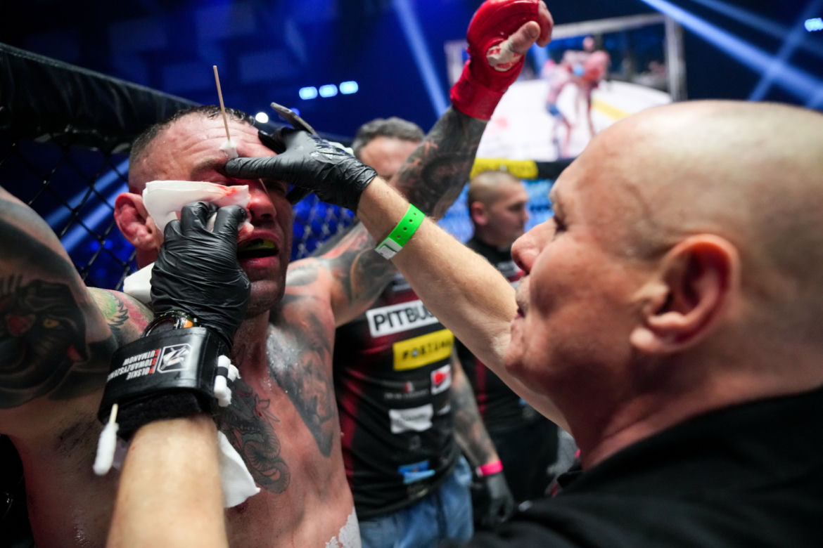 Paczuski: Potworne rozcięcie na twarzy gwiazdy KSW