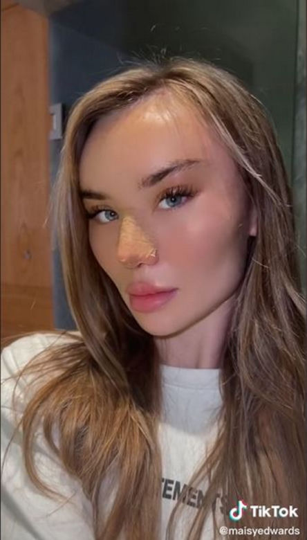 Znana influencerka pojechała do Turcji "zrobić" sobie nos. Wydała 50 tys. zł, fani bezlitośni: "Jest gorzej"