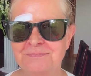 Barbara Busztynowicz miała wypadek! Skończyło się szyciem. Nikt się nie zatrzymał