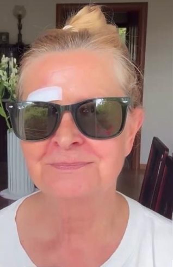 Barbara Busztynowicz miała wypadek! Skończyło się szyciem. "Nikt się nie zatrzymał"