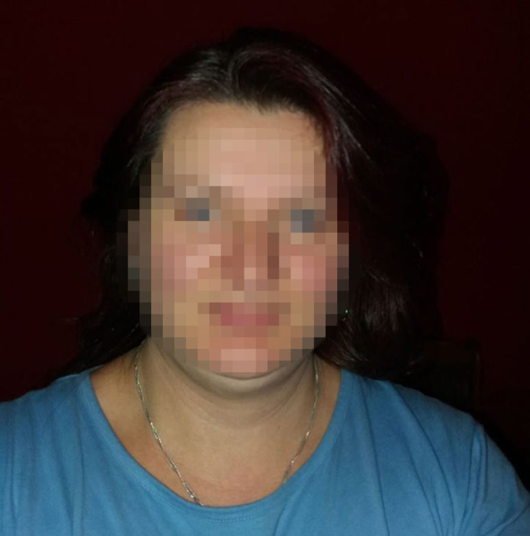 Psy pogryzły głowę i twarz Sebastianka