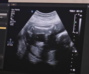 Złoty chłopak odcinek 277