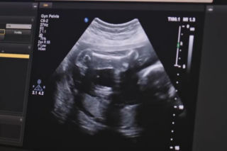 Złoty chłopak odcinek 277