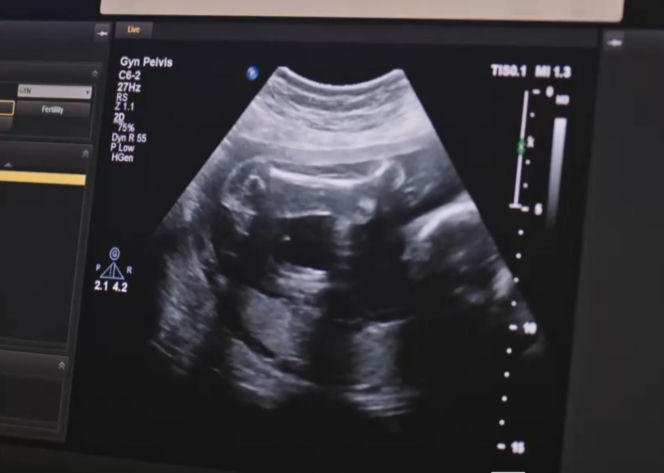 Złoty chłopak odcinek 277