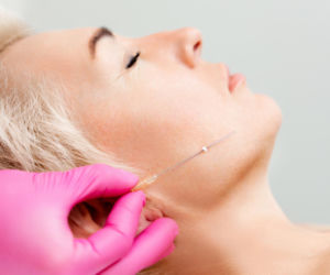 Nici liftingujące zamiast operacji. Jak unoszą policzki i poprawiają owal twarzy