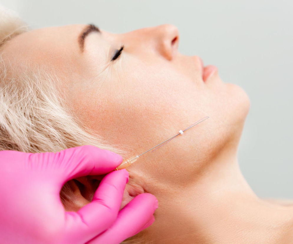 Nici liftingujące zamiast operacji. Jak unoszą policzki i poprawiają owal twarzy