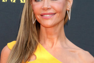 Denise Richards i jej lifting twarzy szokują. Aktorka się tłumaczy i pokazuje nagranie z zabiegu