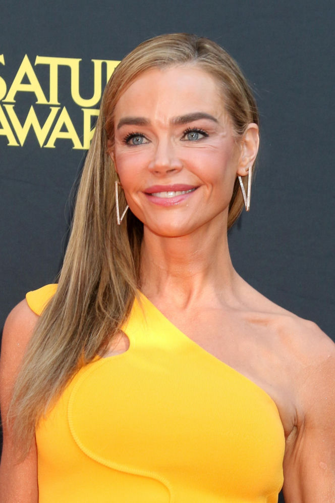 Denise Richards i jej lifting twarzy szokują. Aktorka się tłumaczy i pokazuje nagranie z zabiegu