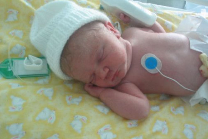 wczesniak opieka nad wczesniakiem na oddziale neonatologicznym
