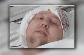 Szymon walczy z glejakiem. Trwa dramatyczna zbiórka na leczenie