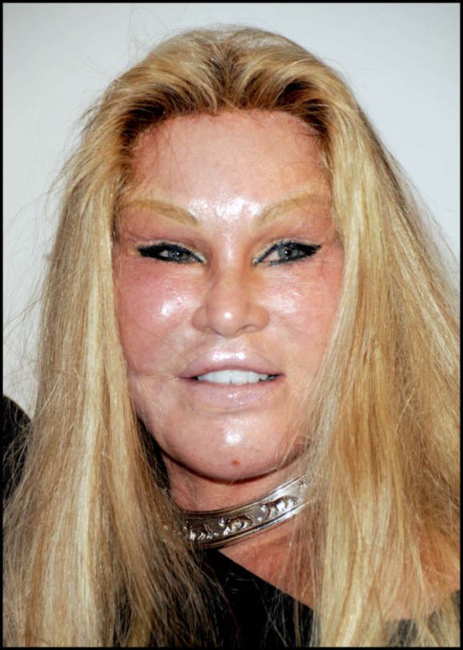 Jocelyn Wildenstein, ofiary operacji plastycznych