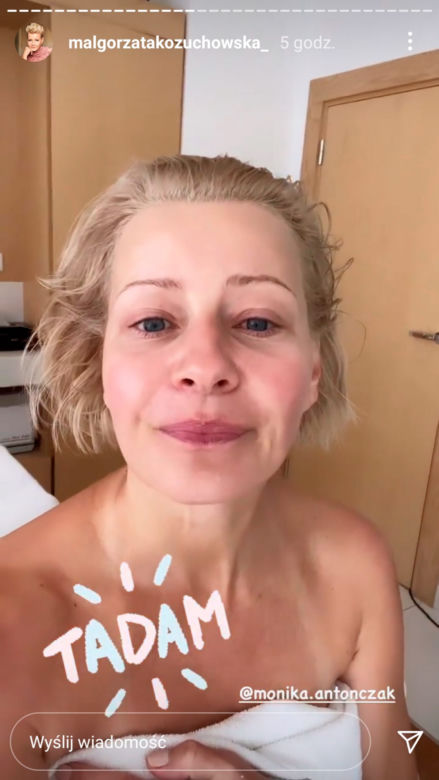 Małgorzata Kożuchowska podniosła policzki i wygładziła czoło