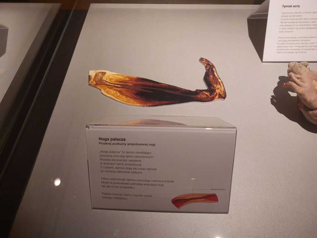 Wystawa Body Worlds w Szybie Wilson w Katowicach