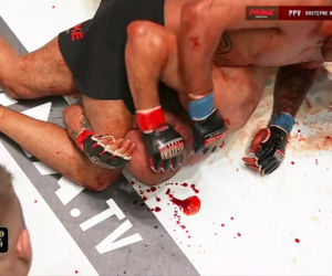 Krwawa rzeź w walce na PRIME MMA