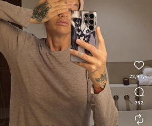 Karolina Gilon zoperowała biust. Zdjęcia przed i po