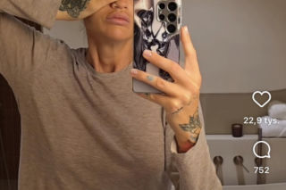 Karolina Gilon zoperowała biust. Zdjęcia przed i po