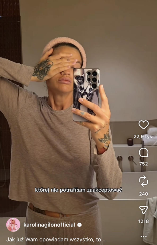 Karolina Gilon zoperowała biust. Zdjęcia przed i po