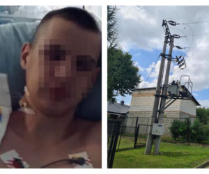 14-latek wspiął się na słup, obrażenia są ogromne. Wszystko przez Tik-Toka?! Przyszły strażak walczy o życie! 