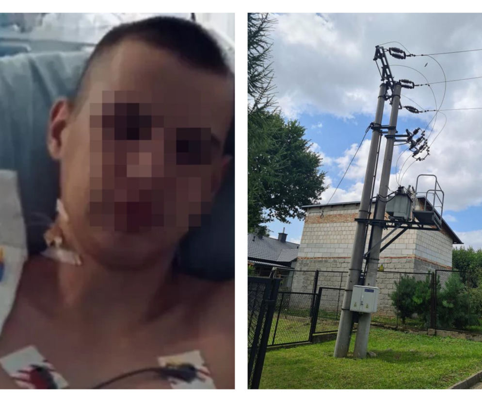14-latek wspiął się na słup, obrażenia są ogromne. Wszystko przez Tik-Toka?! Przyszły strażak walczy o życie! 