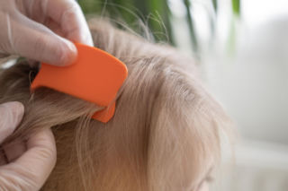 Rodzice często mylą gnidy z łupieżem. Ten prosty test rozwiewa wątpliwości