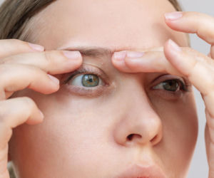 Masz na twarzy białe grudki? Dermatolodzy wskazują kosmetyk, który najczęściej wywołuje prosaki